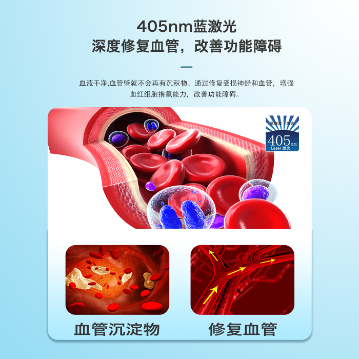 为什么说405纳米蓝激光能修复血管？原理是什么？